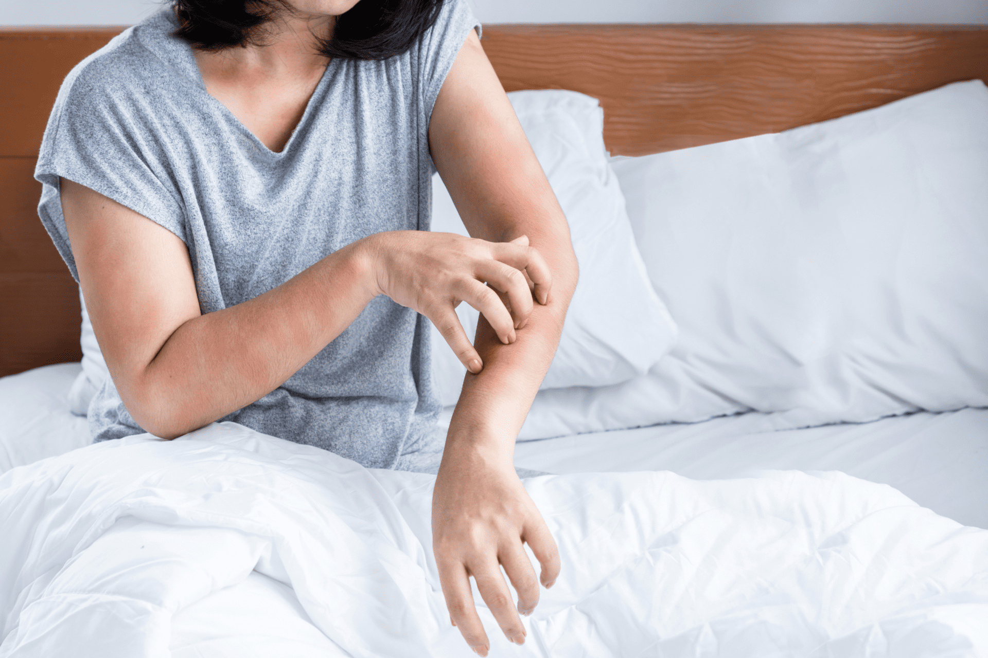 lady with skin rash